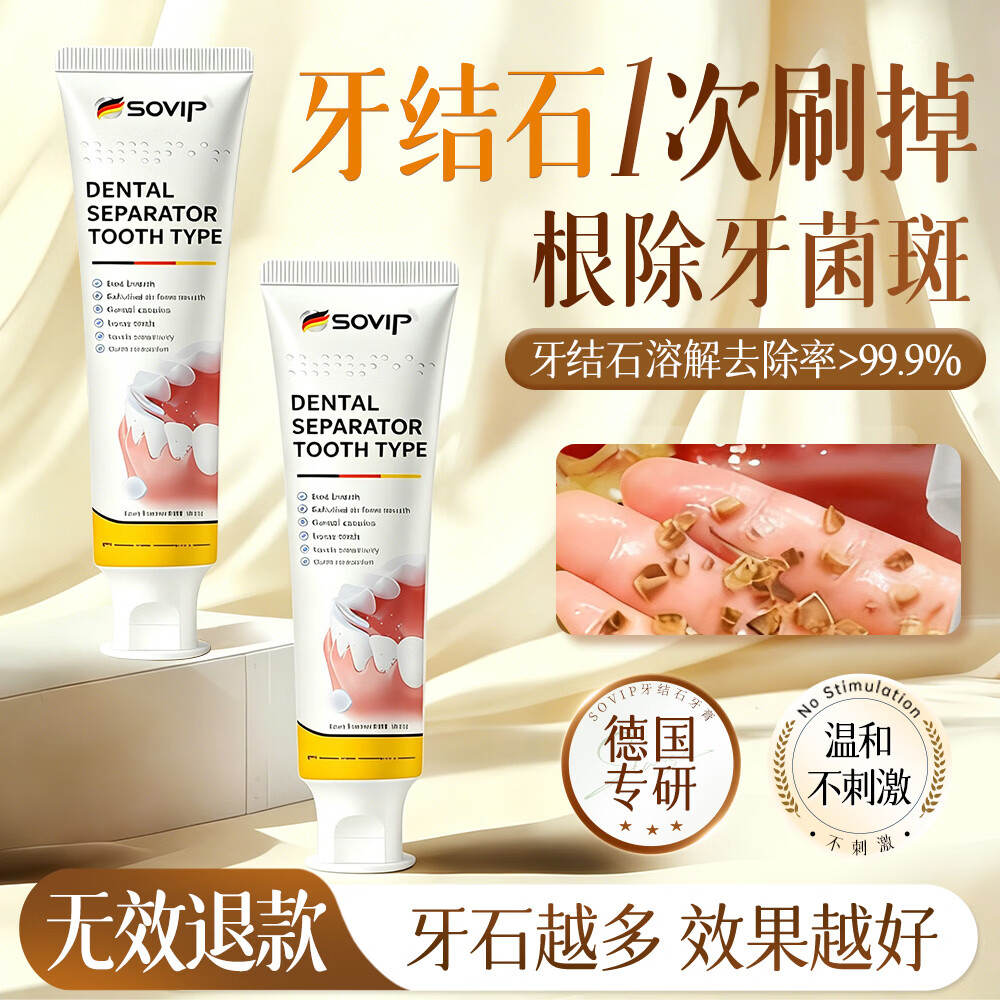 SOVIP牙结石专用牙膏去牙结石去黄去渍美白除臭清新口气去口臭清理神器 2支*150g周期装【溶解牙垢 美白牙齿】