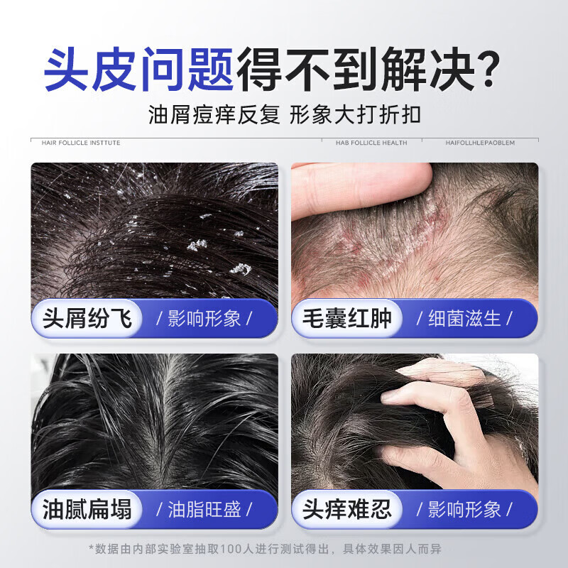 同仁堂(TRT)二硫化硒洗发水去屑控油持久蓬松滋养头皮清洁头屑无硅油洗发露 300ml*1瓶装