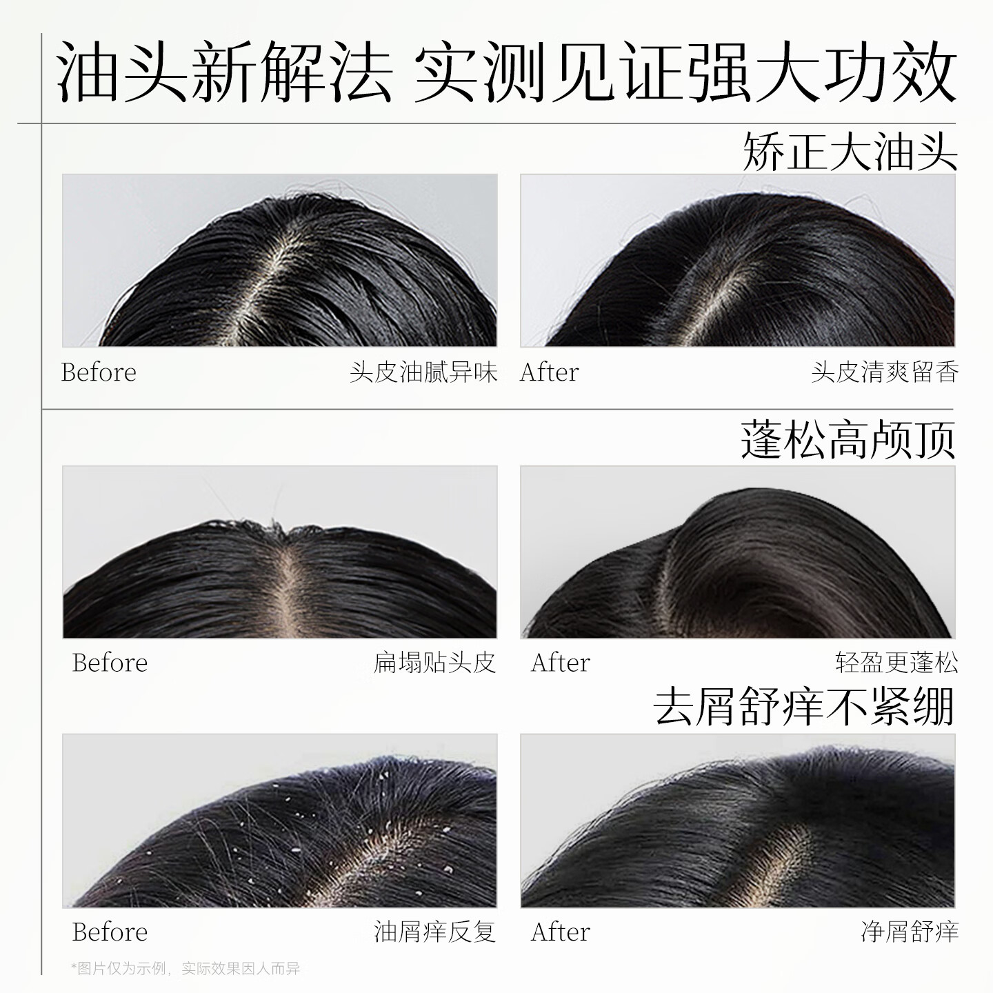 长发小寨淘米水头皮护理洗发水控油蓬松滋养洗发膏【针对干/油性发质】 (升级款)控油蓬爽型435ml*1