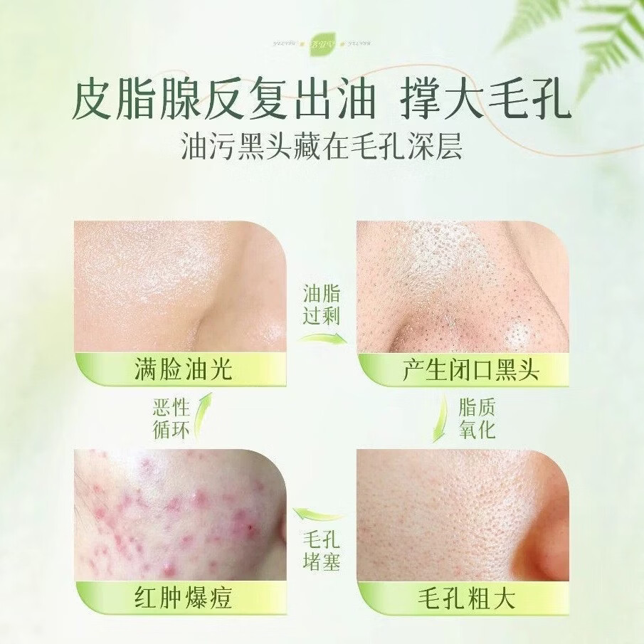 BUV小绿泥洗面奶叶绿素氨基酸洗面奶控油祛痘深层洁净毛孔暑假学生用 3支装【第3支免费，装深度清爽】
