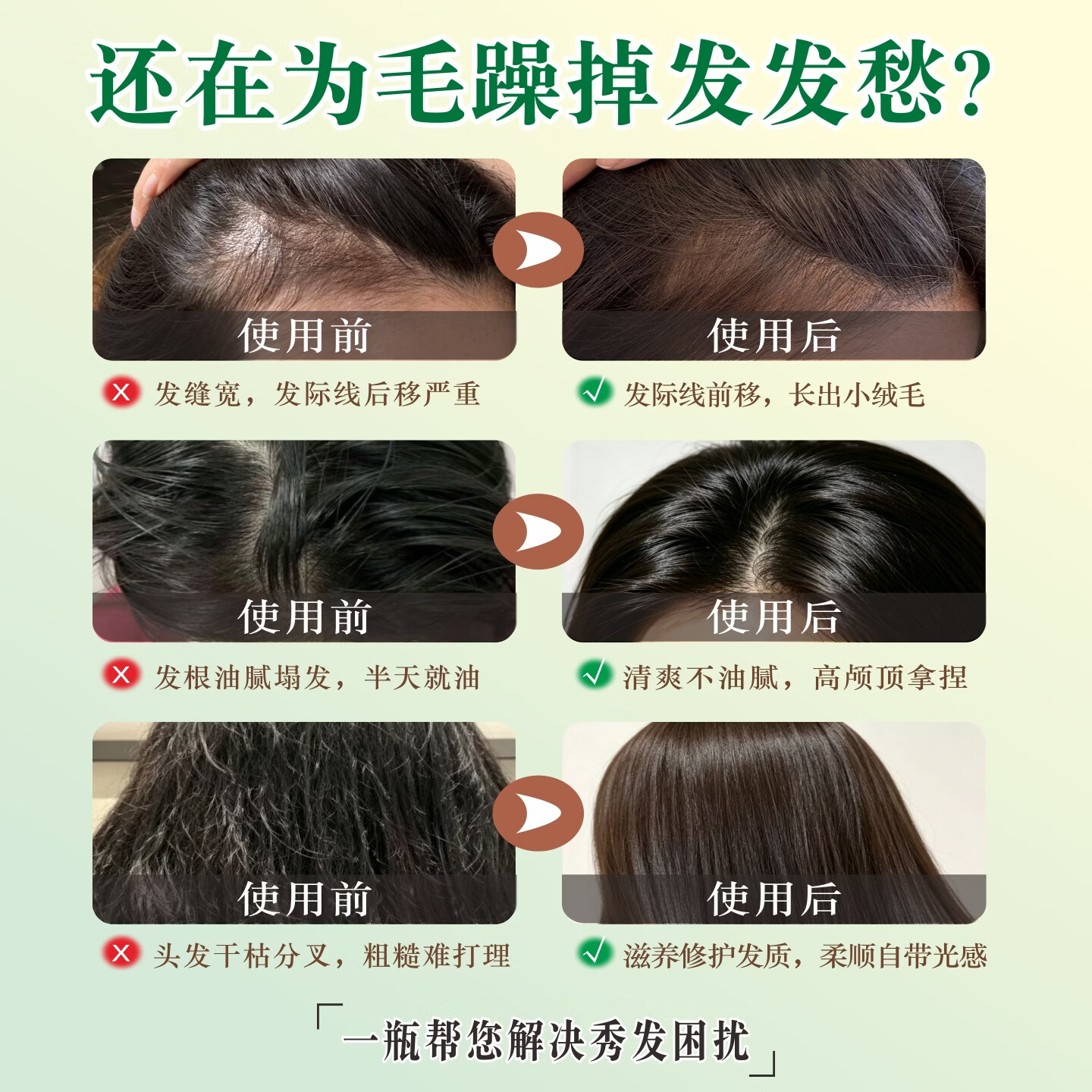 凯丽娜头皮护理精华液补水保湿养发护发干枯毛躁舒缓毛囊精油头皮营养液 500ml一瓶