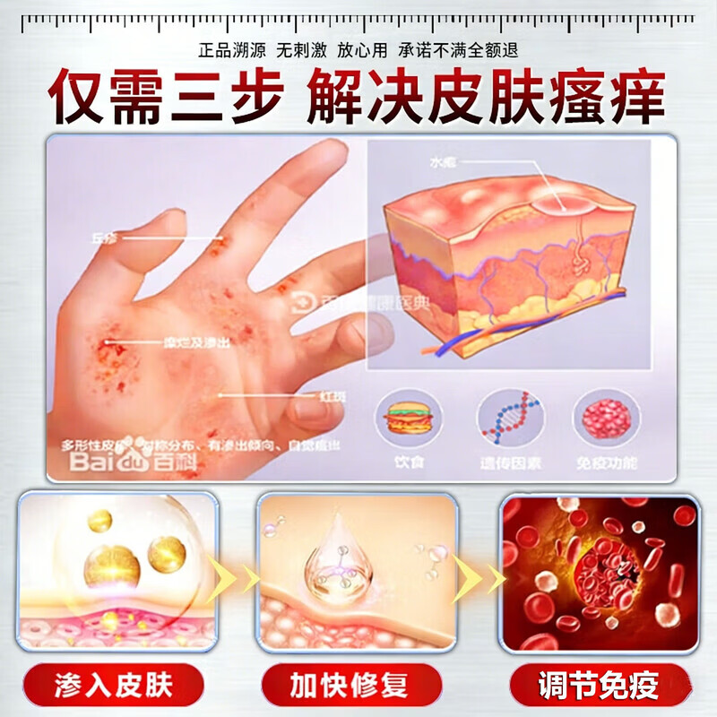 北京协和医学院止痒膏止痒抑菌皮肤瘙痒身体痒止痒特效湿炎皮疹真菌感染过敏药膏 1盒【皮肤瘙痒止痒去湿毒】药膏 香港真菌王百草止痒王祛根i湿毒清
