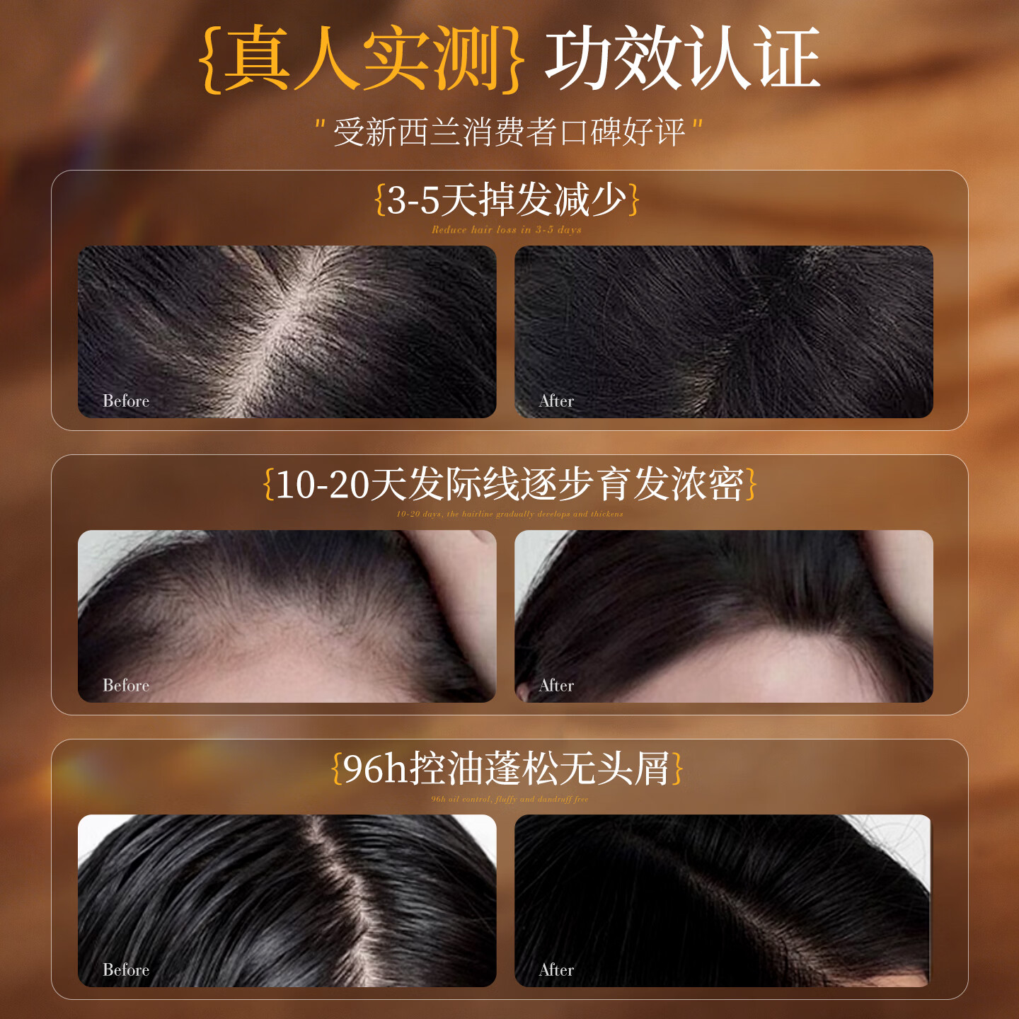 PUNOMO新西兰进口防脱洗发水发育生姜控油去屑蓬松固发养发柔顺男女专用 【防脱固发】洗发水500ml