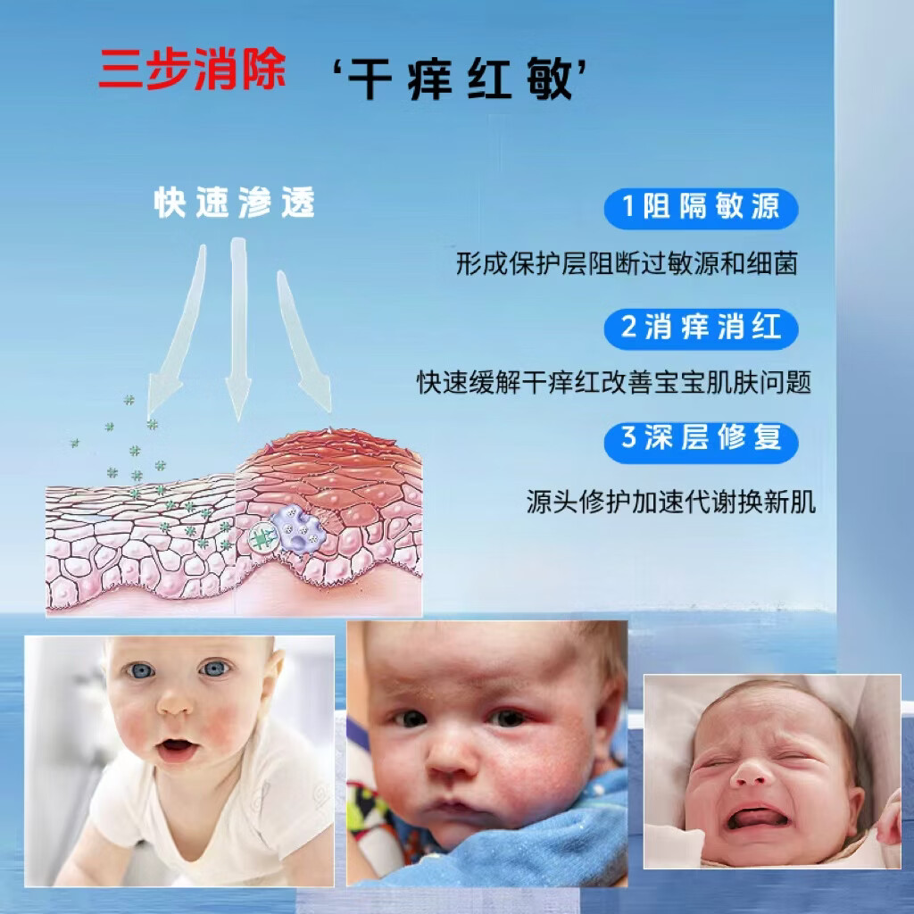 贝婴戎之馆婴亲霜老款抑菌霜宝宝皮肤抑菌膏湿痒婴儿膏皮肤湿痒奶藓红屁屁霜 店长推荐