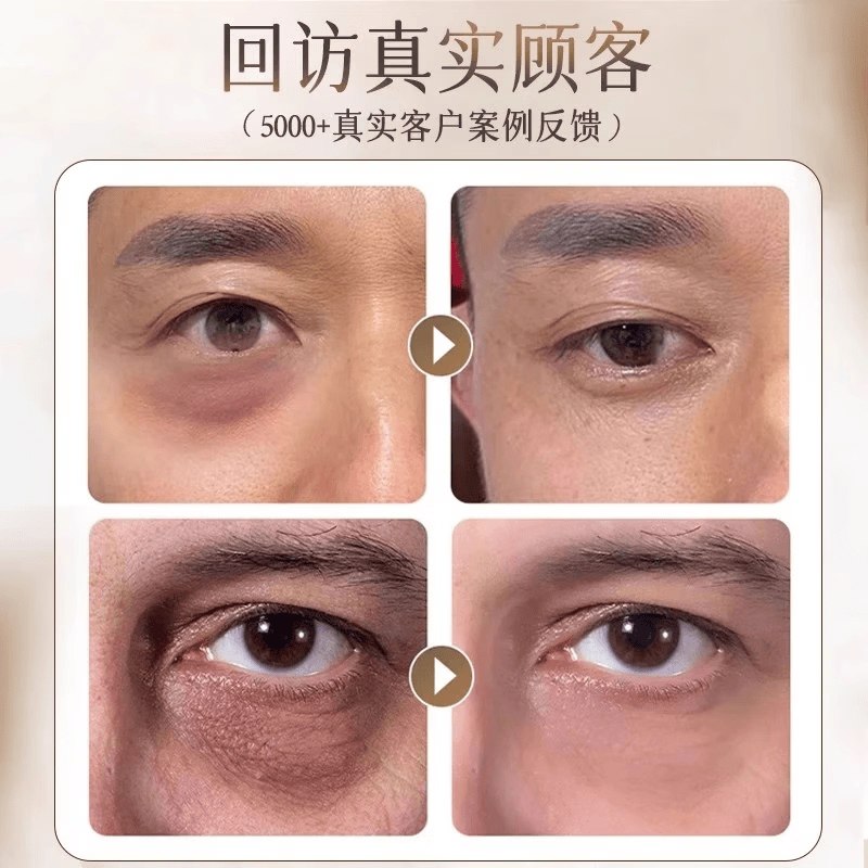 眼袋去除神器男士专用眼霜去重度消除大眼袋严重中老年淡化黑眼圈 特效： 3送2【眼袋不再有】