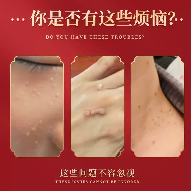 同仁堂克尤皂北京全身肉粒手足腋下脖子通用清洁手工皂去尤瘊颈部 克疣皂旗舰官方1盒
