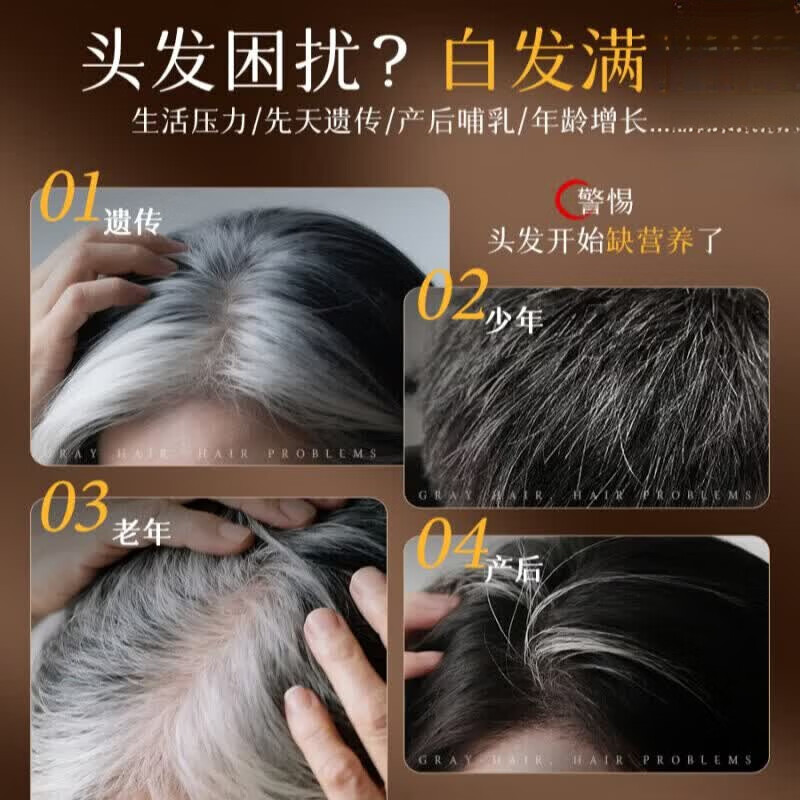 同仁堂（TRT）何首乌生姜洗发水防脱育发固发白发转滋养护黑发根男女通用洗发露 【北京同仁堂】防脱洗发水5瓶装