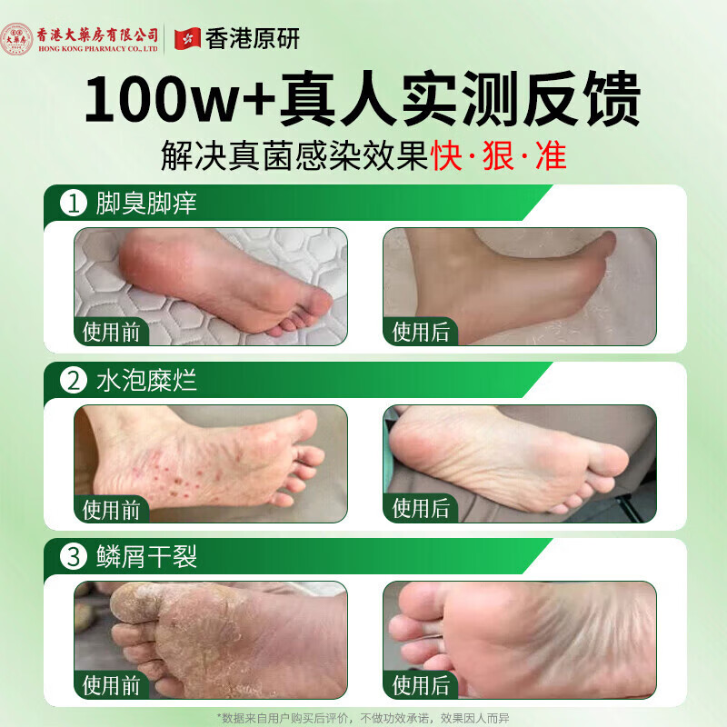香港大药房有限公司贴真菌王皮肤膏手足私处全身适用草本护理温和亲肤官方旗舰正品 3瓶【周期装】98%顾客推荐