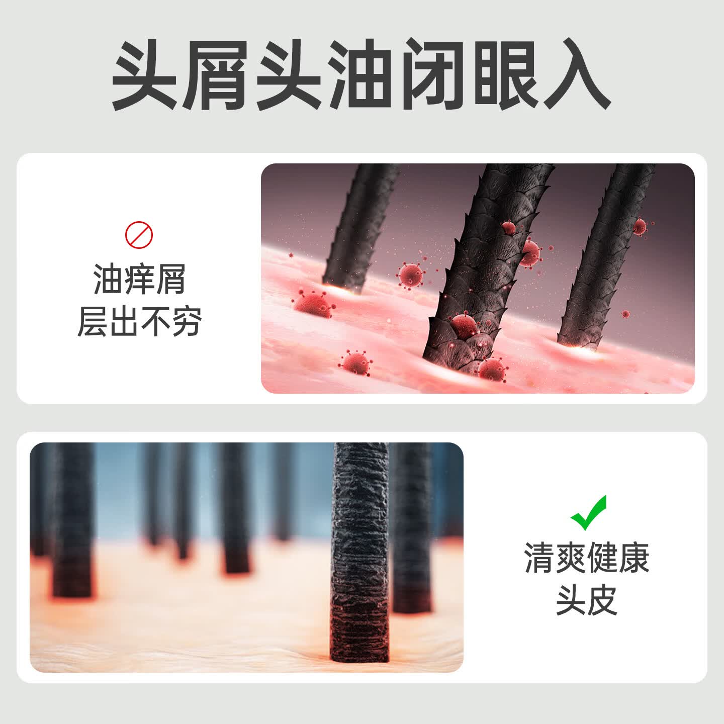 百年扁氏艾草去屑止痒头皮素 天然植萃洗发水柔和洁净控油改善头皮洗发水 2瓶装