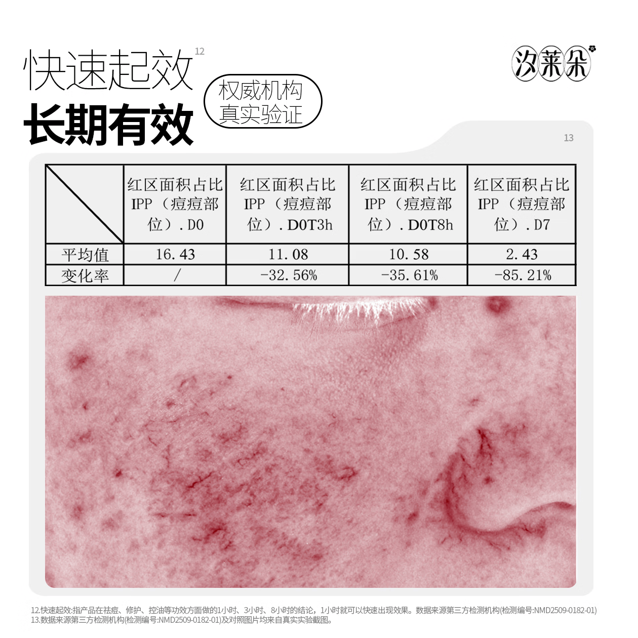 汐莱朵SLAOR/汐莱朵黄柏液祛痘凝露10g|舒缓祛痘|油性混合性|草本精华| 黄柏液祛痘凝露10g