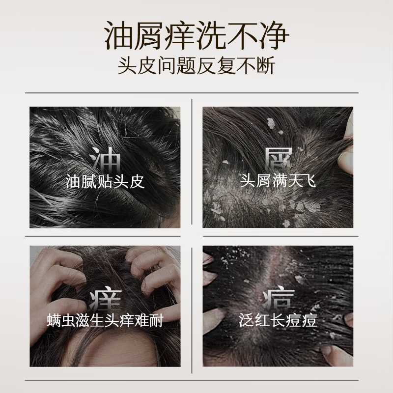 OSXE【专攻油痒屑】德国进口二硫化硒洗发水深层控油蓬松止痒除螨正品 【根源去屑止痒】二硫化硒洗发水500ml