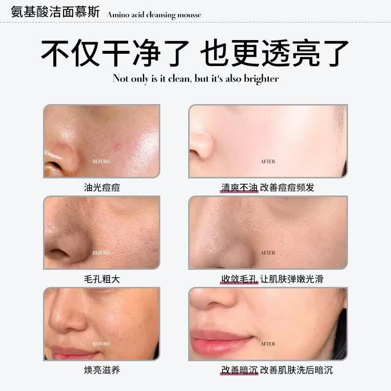 膜秀堂氨基酸洁面慕斯深层清洁泡沫清爽控油收紧毛孔祛痘黑头保湿洗面奶 100g 膜秀堂氨基酸洁面乳(