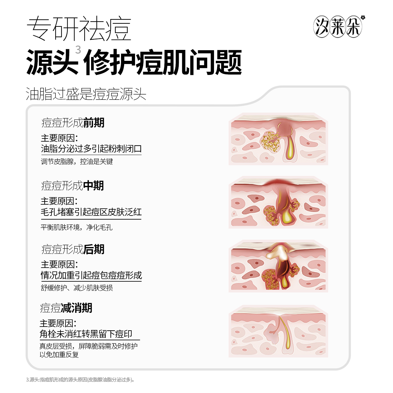 汐莱朵SLAOR/汐莱朵黄柏液祛痘凝露10g|舒缓祛痘|油性混合性|草本精华| 黄柏液祛痘凝露10g