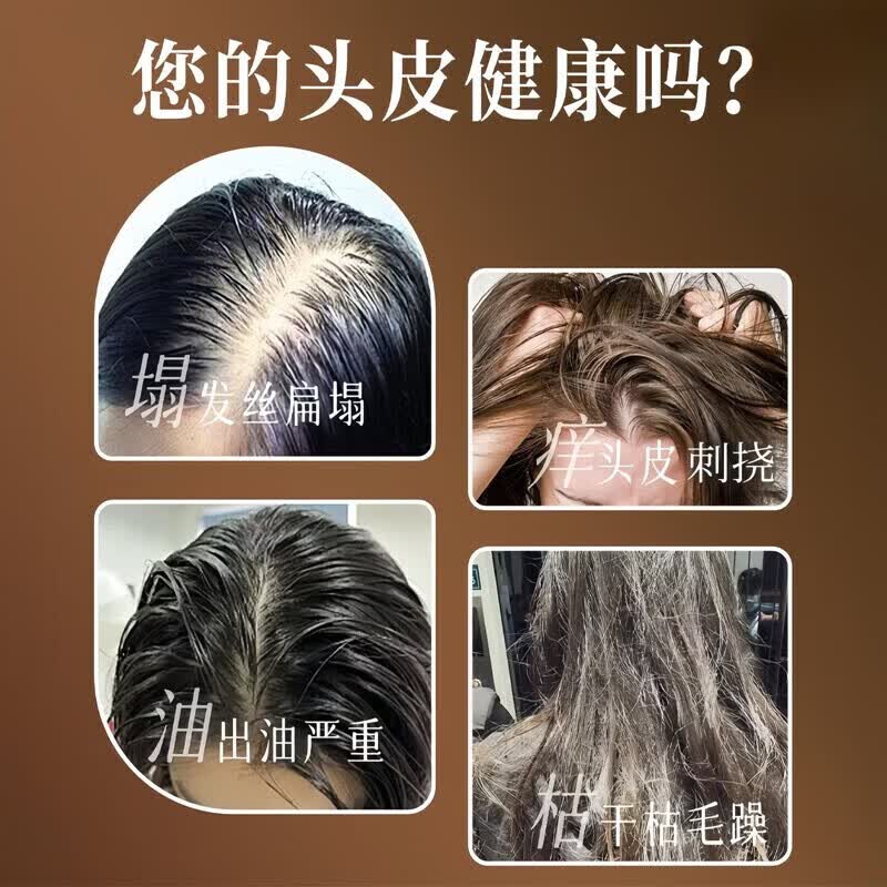 同仁堂（TRT）何首乌生姜洗发水防脱育发固发白发转滋养护黑发根男女通用洗发露 【北京同仁堂】防脱洗发水5瓶装