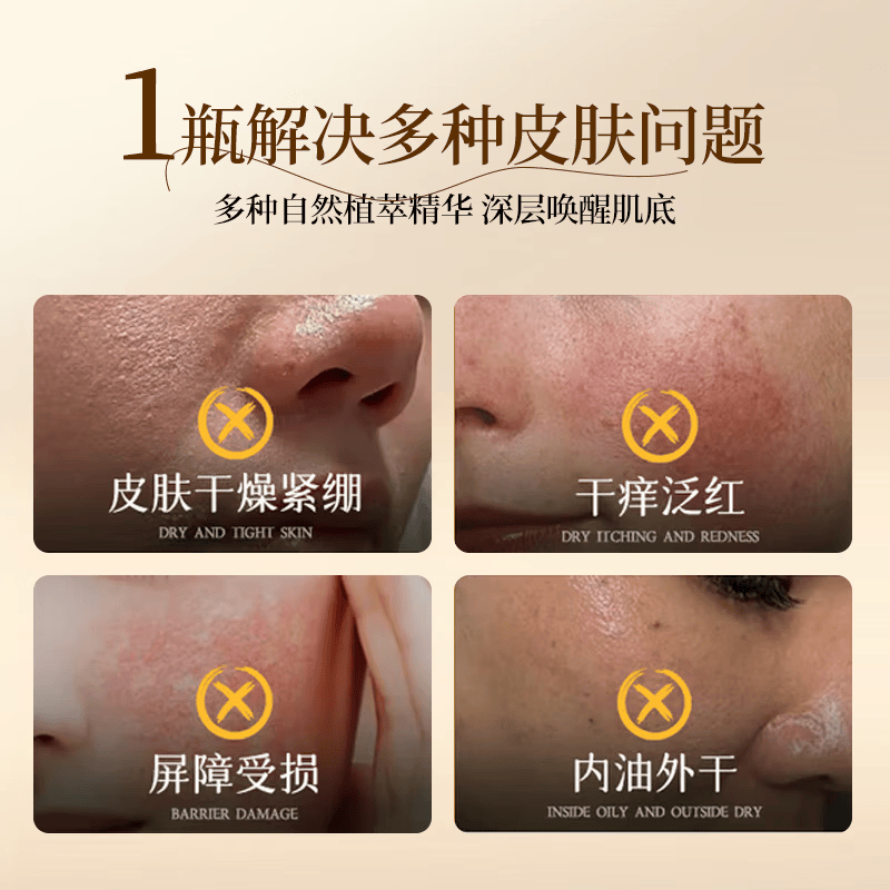 COORIONARA/膜焕液 皮脂膜修护液舒缓抗皱水光感湿敷精华水 【6件装】柔光喷雾版80ml