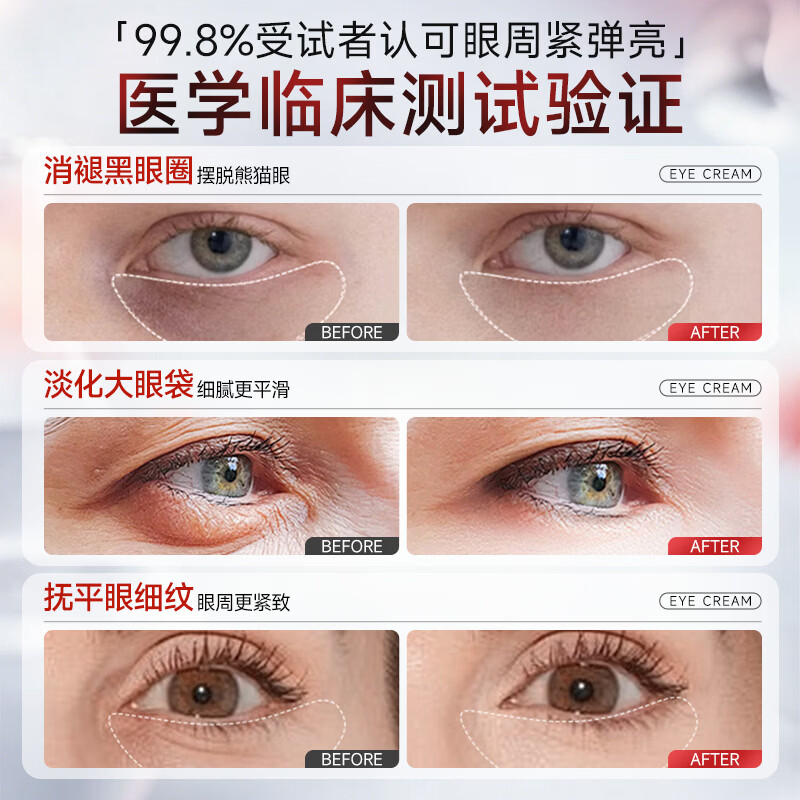 喜辽妥多磺酸极速消袋膏胜肽眼部修复软膏去眼袋消除专用 5盒装 买三赠二【巩固装】 【官方直售】