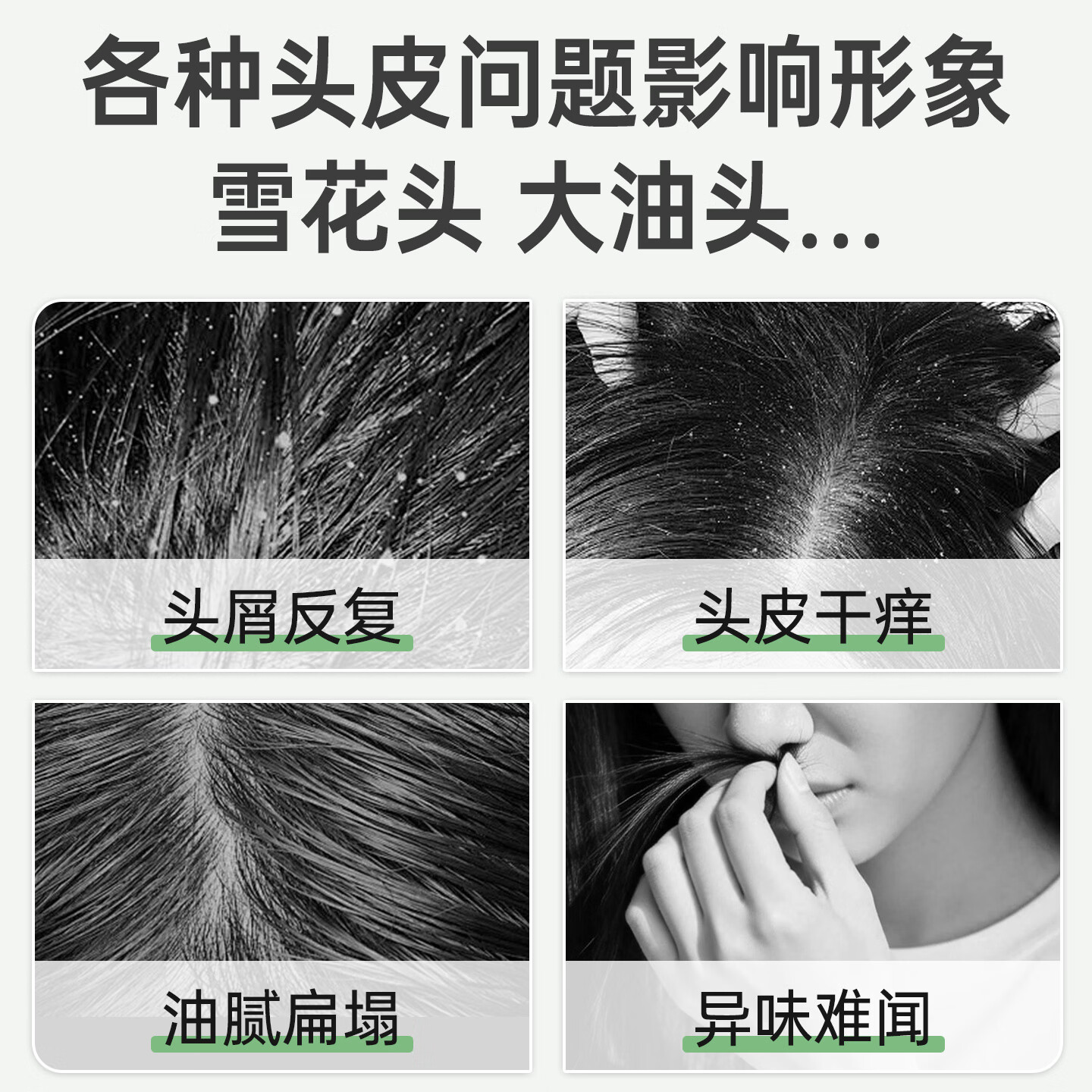 百年扁氏艾草去屑止痒头皮素 天然植萃洗发水柔和洁净控油改善头皮洗发水 2瓶装