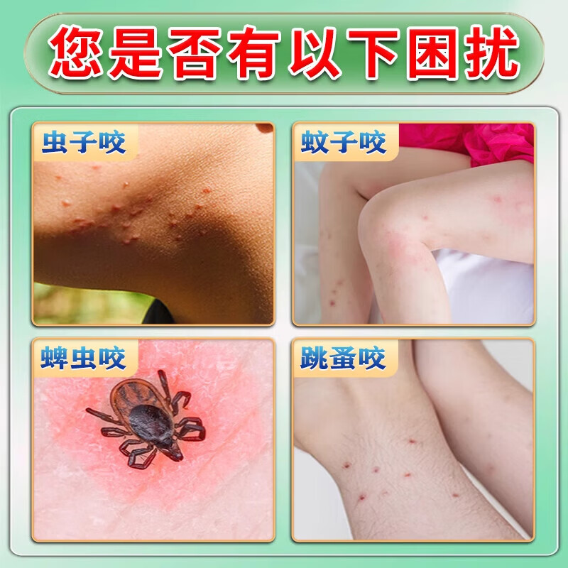 妙药堂夏季蚊虫叮咬止痒消肿婴儿100%止痒消肿药膏喷雾剂紫草膏露营神器 特效:九盒装【家庭必备】
