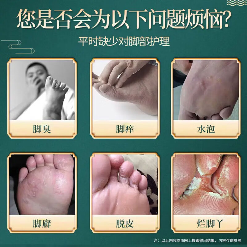 汉艾东方韵脚气喷雾脚痒脚汗脚臭喷雾脱皮烂脚丫水泡型专用脚气喷剂 脚气喷剂30ml×2瓶