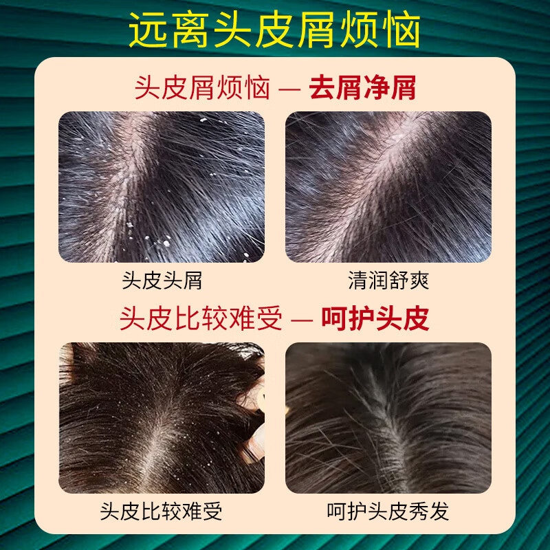 歌澜艾蒿去屑清润洗发水500ml草本植物去屑止痒洗发液清爽柔顺洗头露 歌澜艾蒿去屑清润洗发水2瓶
