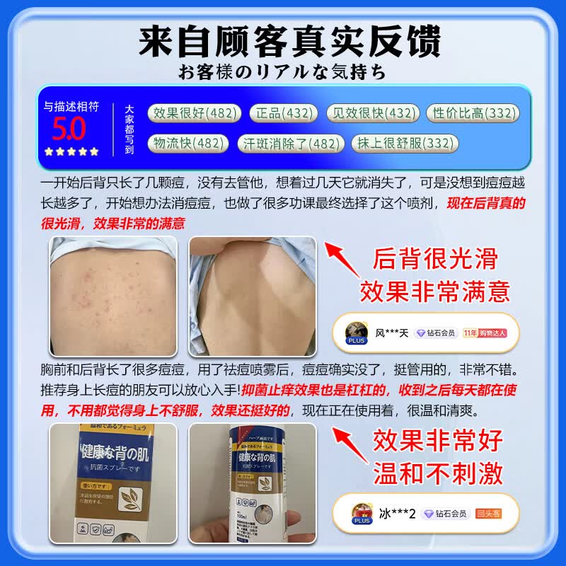东田后背部长痘痘毛囊炎专用前胸背粒消祛痘止痒抑菌真菌感染药膏喷雾 一盒装【多买多送】发货特效快 毛囊炎真菌感染专用祛痘除螨喷雾剂