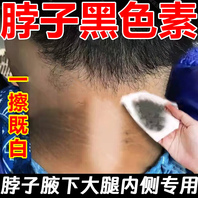 贝缇莎脖子黑色素i去除黑棘皮症去除i脖子黑色素沉淀腋下美i白去i黑神器 （5盒装） 【巩固装超值】