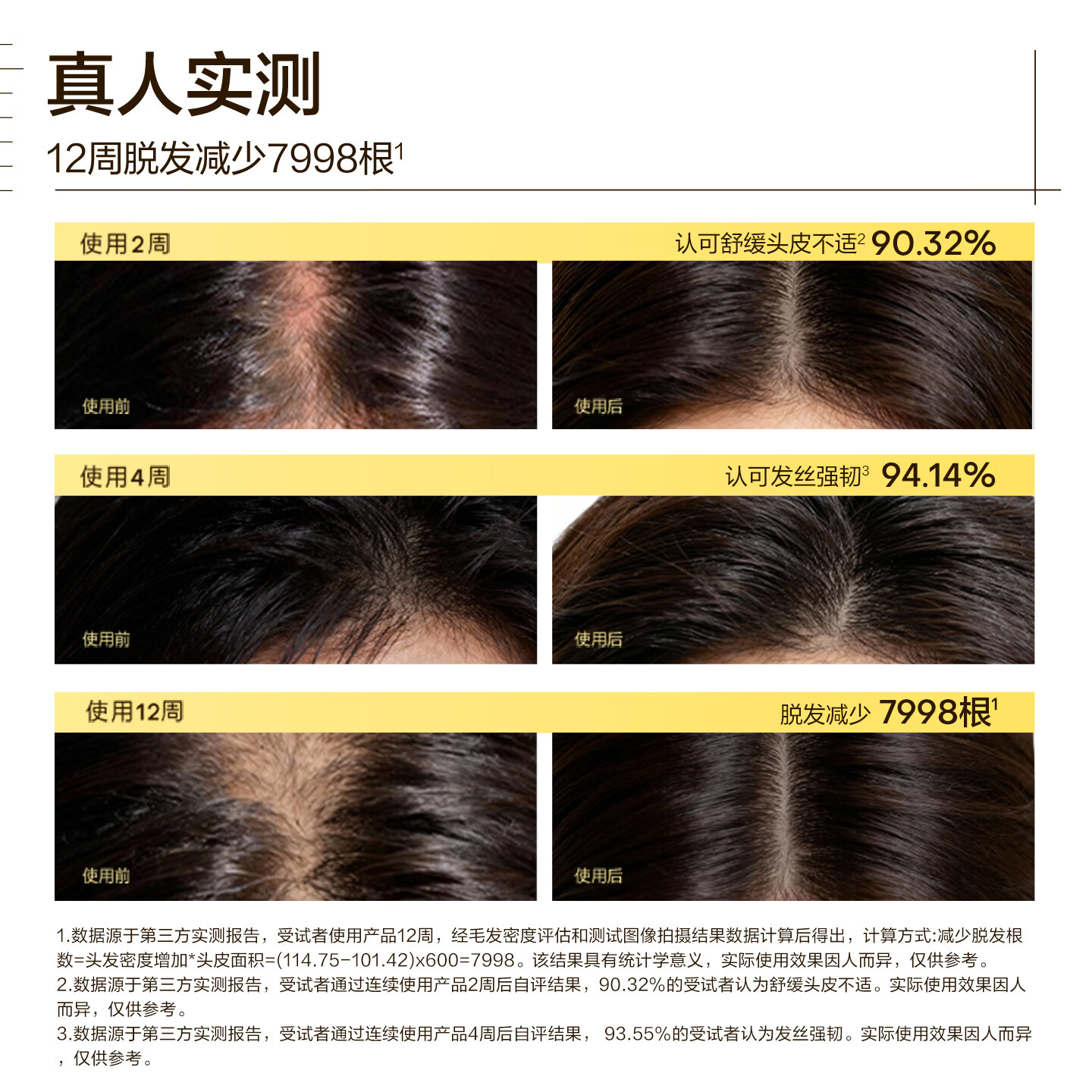 极方(KYOCA)赋活401腺苷氨基酸3倍蛋白强韧防断发护发乳【礼物】 防脱修护洗发水300ml+头皮固发精华60ml