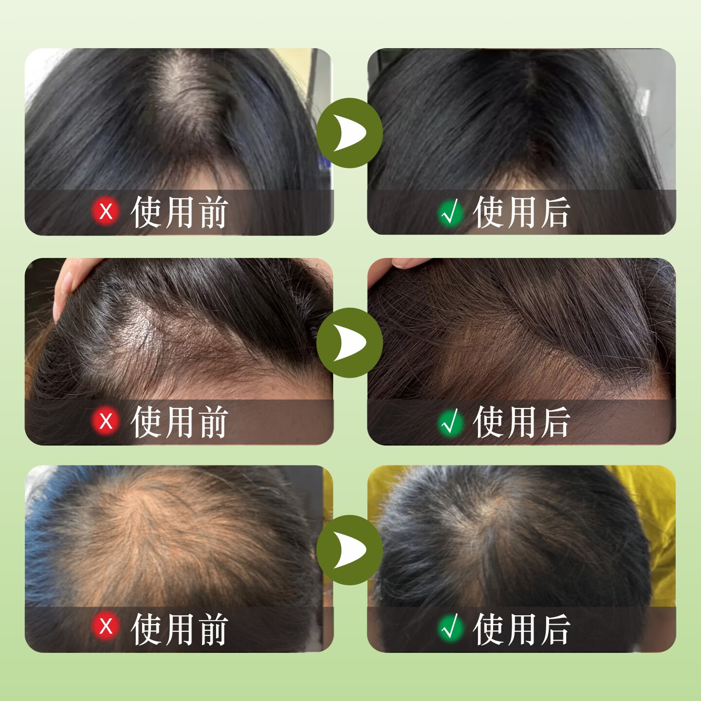 凯丽娜侧柏叶天然头皮滋养养发液草本精华滚珠按摩发缝护理萃取精华液 10ml三瓶