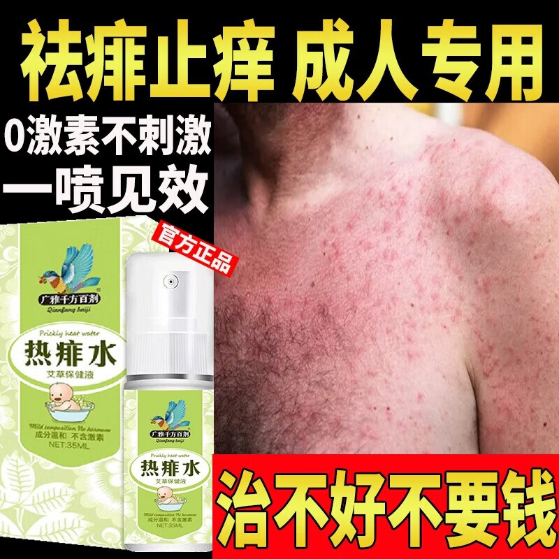 广雅夏季热痱子水祛痱止痒喷雾痱子粉婴儿专用止痒祛热痱子男士爽身粉 特效:买5送3【永不再范】