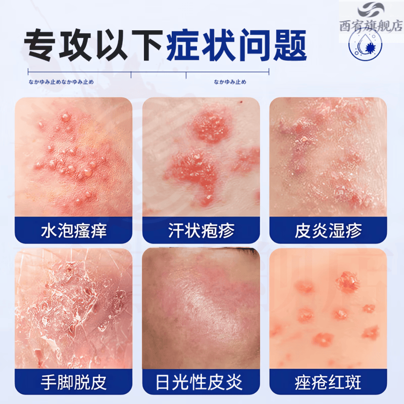 新适确得卤i米松三i氯生乳膏适用于脂溢性皮炎痒湿湿疹神经性皮炎抑菌止痒 1盒【见效装】  品牌自售