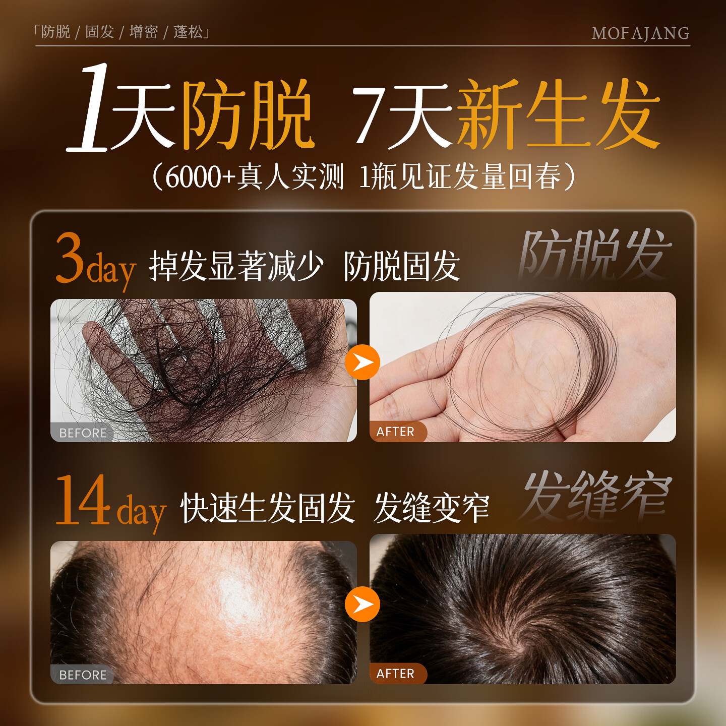 三个魔发匠可比落防脱育发液固发头发生长发剂激活毛囊增发密发剂头皮精华液 【药房同款】重度脱发止脱精华液 50ml*1支