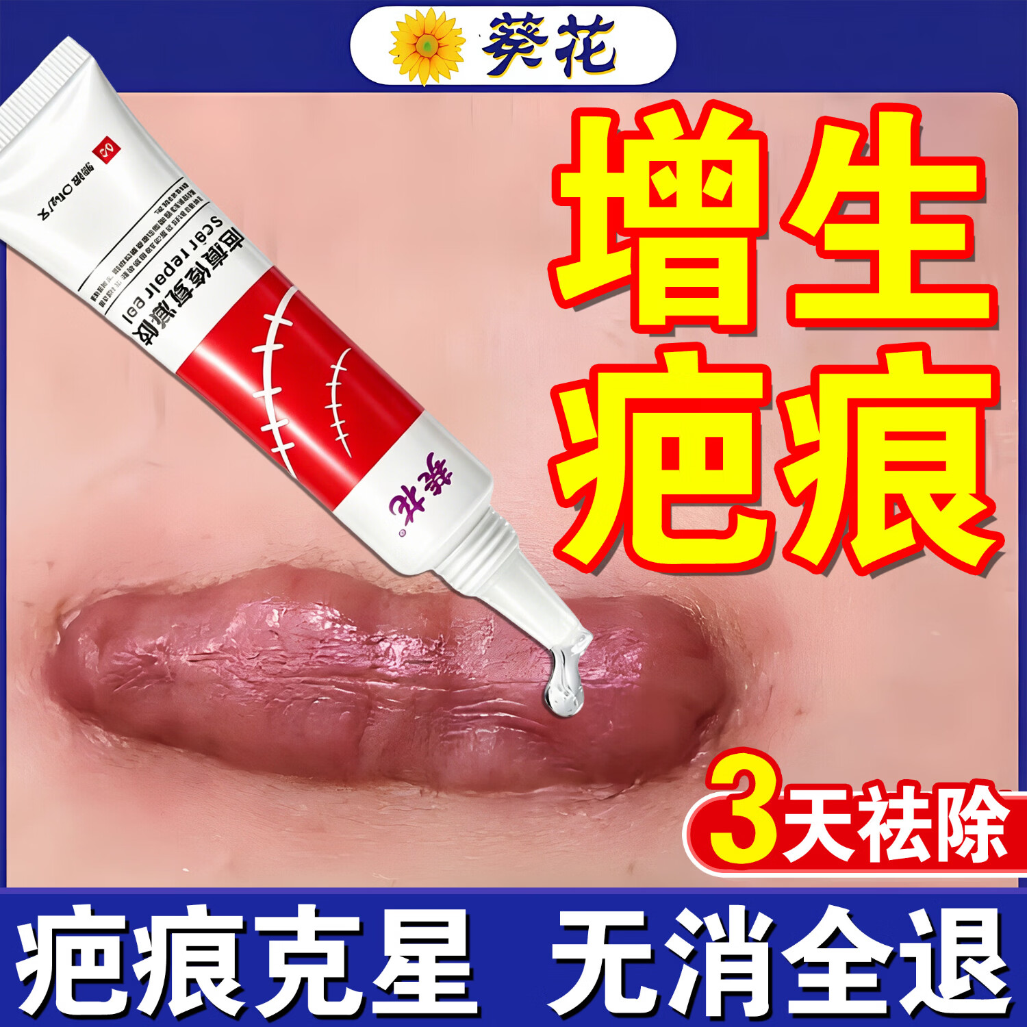 葵花疤痕增生凸起痒去除疙瘩去疤痕修复凝胶医院专用祛疤膏除新旧疤痕 1盒【3cm小疤】轻松修复