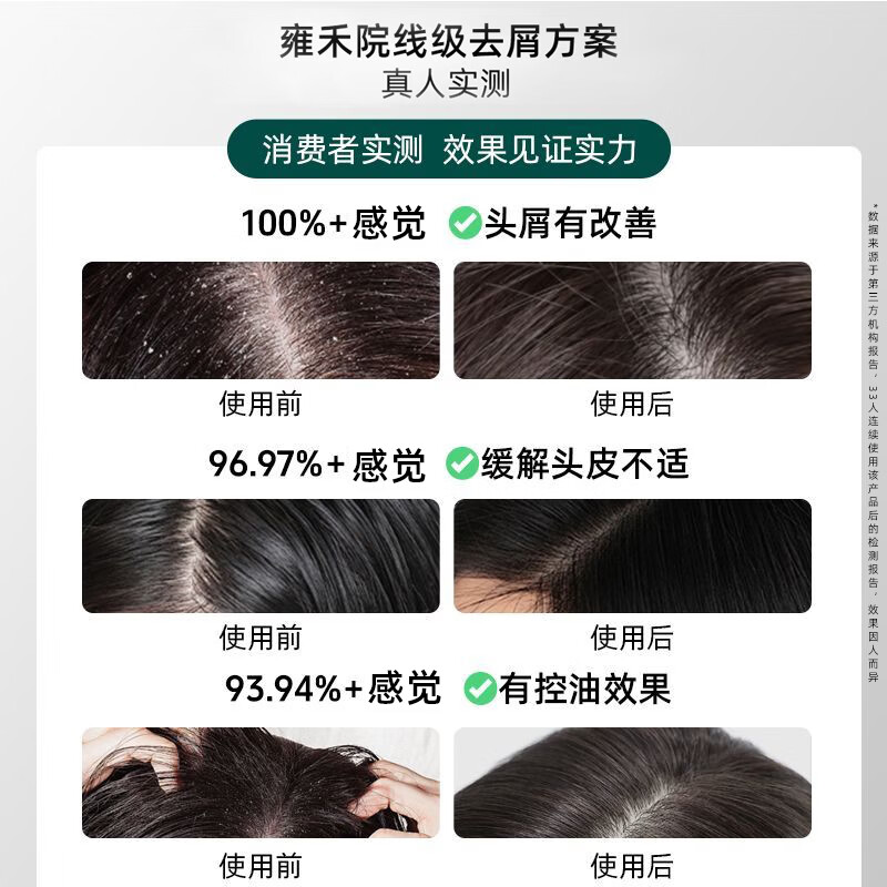 史云逊（Svenson）二硫化硒洗发水 清爽控油去屑 温和清洁保湿舒缓头皮男女通用 250ml 单瓶【日常家用装】