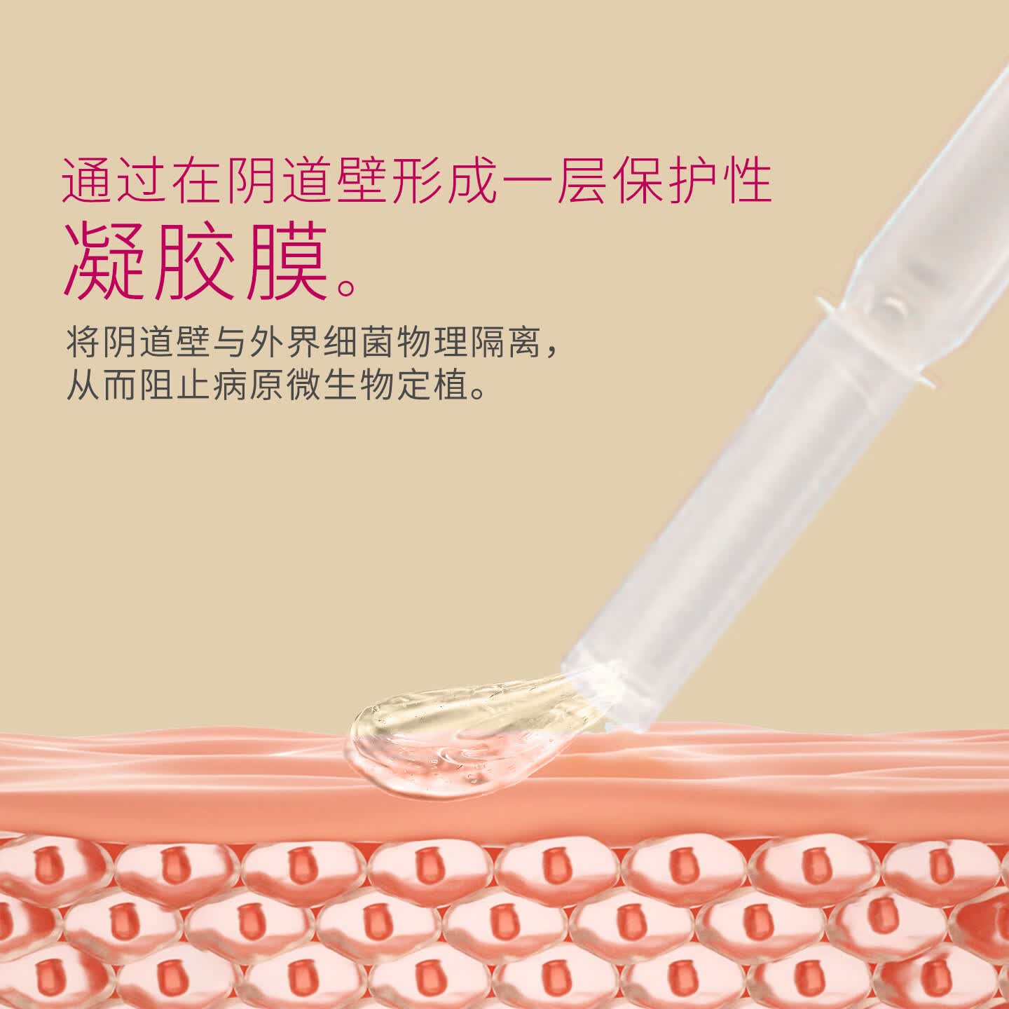 秀雨医用妇科凝胶女性医用私处专用 医用妇科凝胶(1盒5支装)