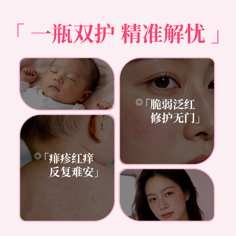 宇津进口桃子水日版婴儿宝宝桃叶精华露儿童热疹专用液体爽身粉痱子水 【日版原装】桃叶爽身露200ml*1瓶+柔纸巾80抽*2包