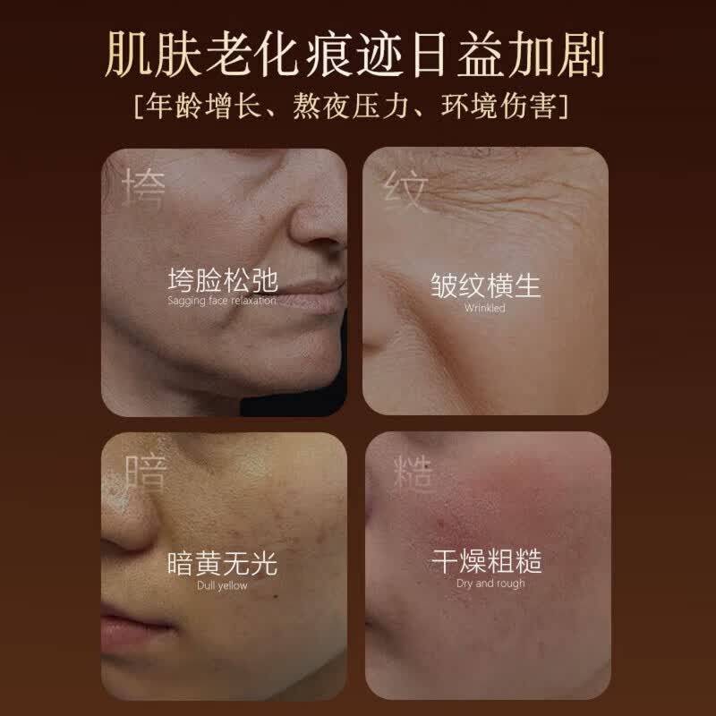 沐刻精华液淡斑精华液色斑淡化提亮肤色去黄改善暗沉正品官方旗舰 3盒装 买二赠一【周期装】持证美白 【官方旗舰 京质保障】