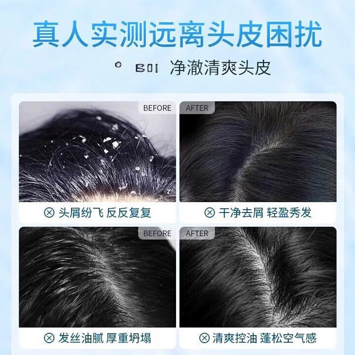 六和乾坤南京同仁堂个人护理洗发水二硫化硒去屑洗发水深层清洁控油洗发露 【升级款】1瓶装【500ml大容量】 【有防伪标志买的放心】