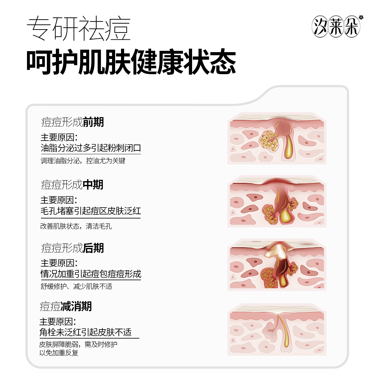 汐莱朵SLAOR/汐莱朵黄柏液祛痘凝露10g|舒缓祛痘|油性混合性|草本精华| 黄柏液祛痘凝露10g
