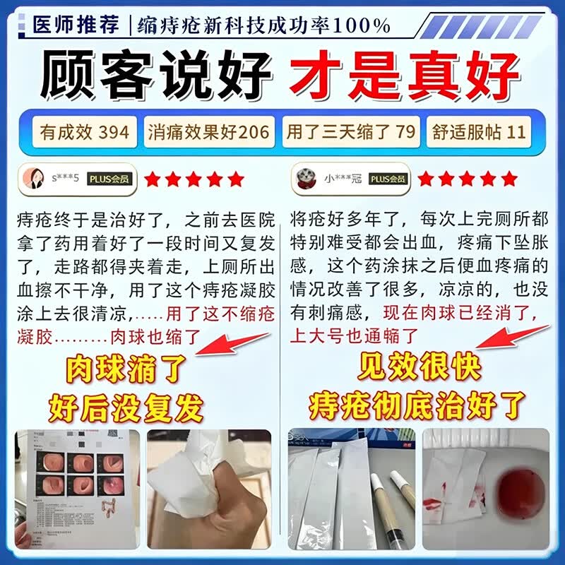 今古透日本原装进口痔疮膏痔疮凝胶专用去肉球断根专用特强效药痔治根断 100%特效:5+4【已帮助2w+患者】 痔疮膏内外混合痔丨非敖东