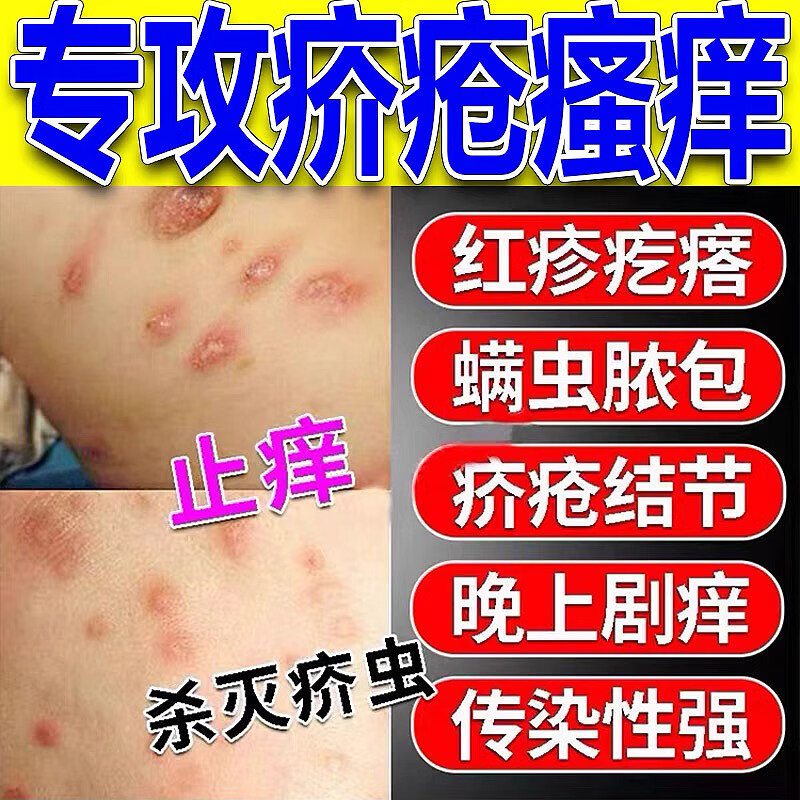 满力净疥疮药特效疥疮结节阴囊疙瘩私处皮肤瘙痒止痒疥螨虫专用硫磺软膏 15盒装-买10送5巩固装