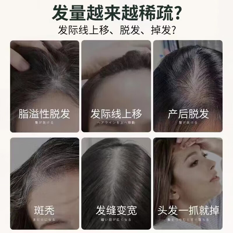 MRYU众康尚品头发滋养液发液七天防脱去屑止痒浓密增长尚志华教授精华 3瓶装买二送一【中度脱发适用】 【官方旗舰 京质保障】