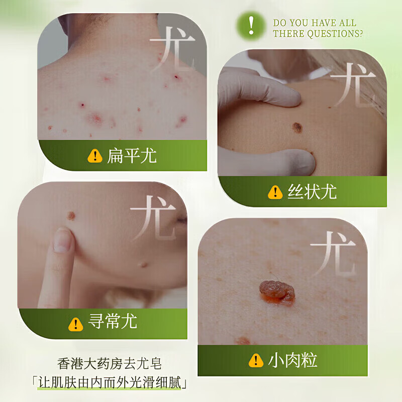 RSRDDY【一洗就掉】祛疣皂瘊尤皂猴子小肉粒痘痘粉刺清洁去尤香皂全身皂 一盒【初步祛无粒】26%客户选择