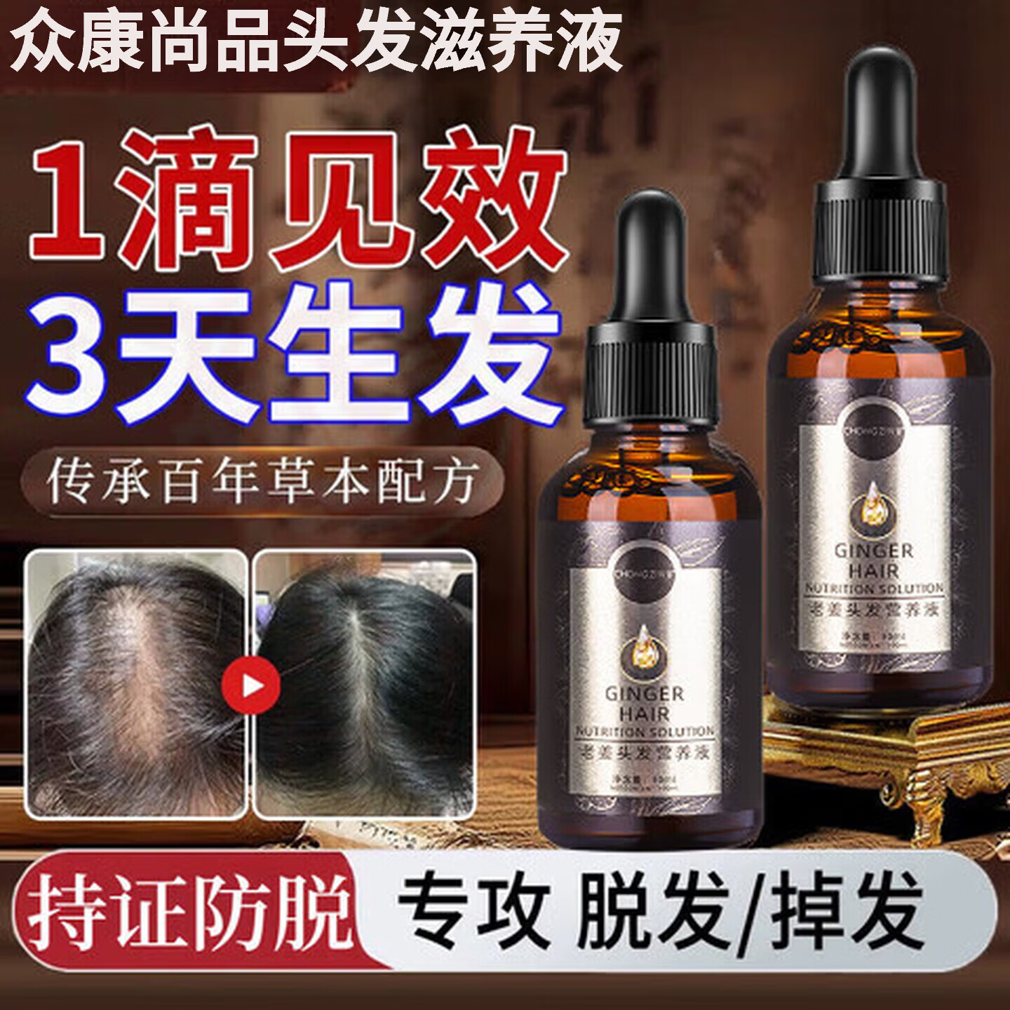 MRYU众康尚品头发滋养液发液七天防脱去屑止痒浓密增长尚志华教授精华 3瓶装买二送一【中度脱发适用】 【官方旗舰 京质保障】