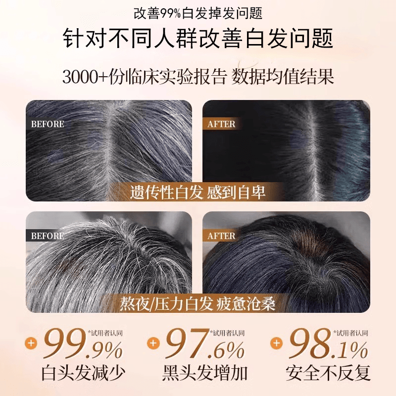 MRYU众康尚品头发滋养液发液七天防脱去屑止痒浓密增长尚志华教授精华 3瓶装买二送一【中度脱发适用】 【官方旗舰 京质保障】