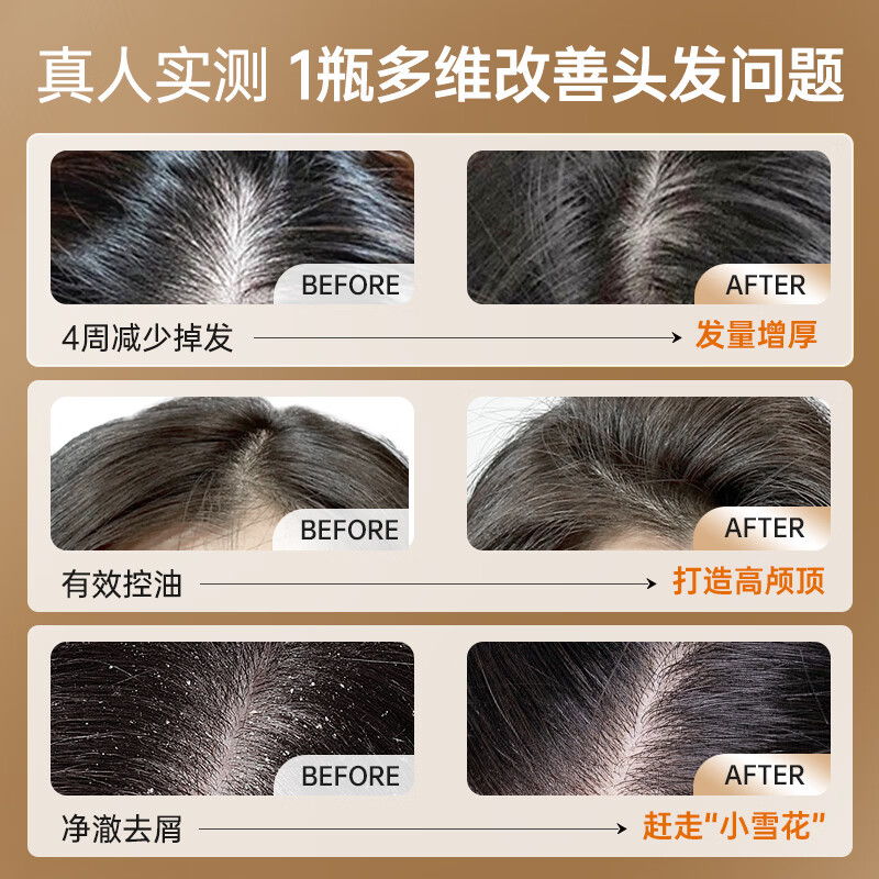 卓蓝雅防脱洗发水控油防脱固发洗发露爆款护发头皮营养剂套装男女士通用 【经典爆款】生姜防脱固发洗发水800ml