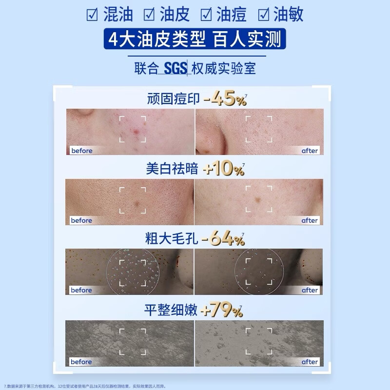 妮维雅(NIVEA)630精粹水油皮补水精华保湿特证美白淡痘印嫩肤细腻礼物618现货 630焕皮水120ml