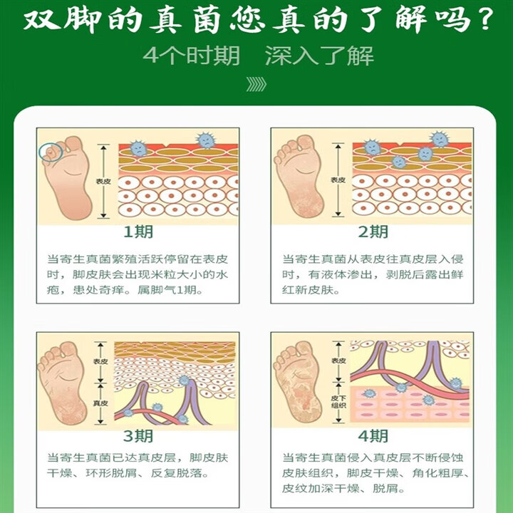 通用梅骆笛足康脚喷组合 新拜足康舒 拜丁氏脚舒 梅骆笛 拜汀氏足康脚 三盒装