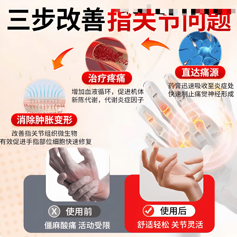 仁和远红外治疗凝胶 关节止痛肿胀膝关节肿胀指腱鞘炎大拇指 五盒装巩固装 腰肌劳损