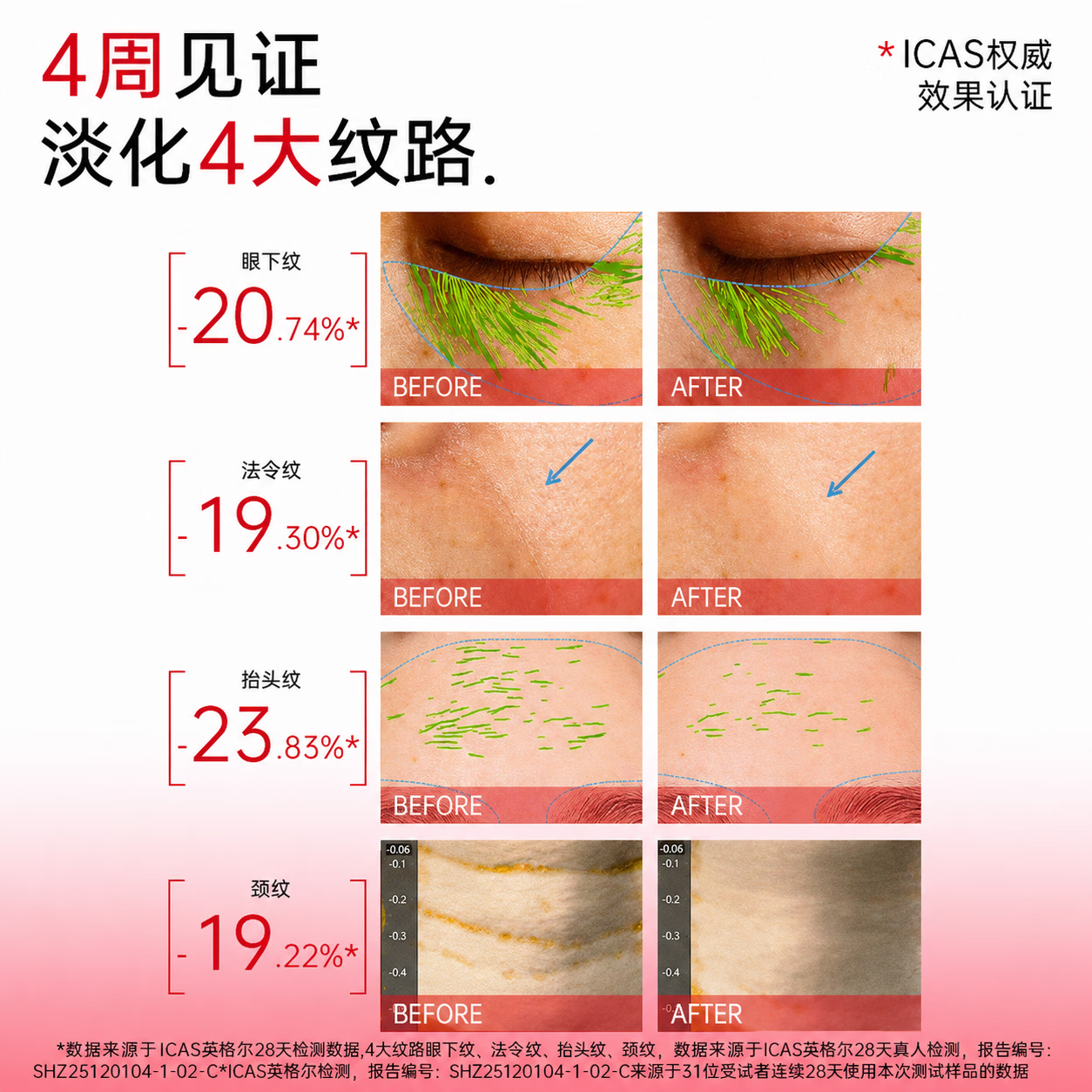 康佳(KONKA)康佳美容仪提拉家用脸部按摩仪淡化法令纹颈纹眼纹面部紧致导入仪 全配款白-4种模式+颈脸两用+美颈霜