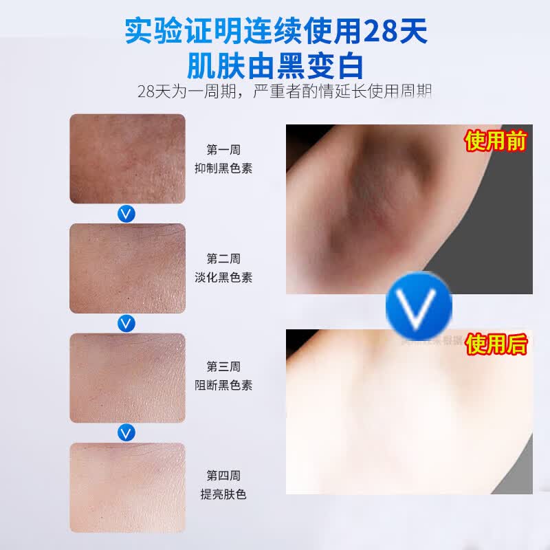 葵花胳膊肘黑色素沉淀去除手肘快速去黑淡化胳膊肘黑色素去黑去皮角质 【三盒】一抹转白